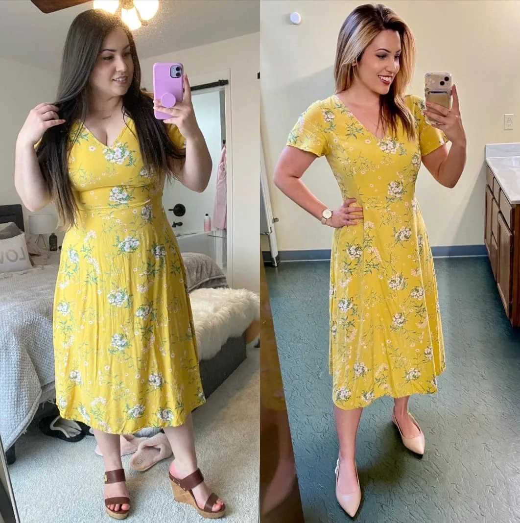 Before and after: Lauren R. in a yellow dress, showing her Flash Burn transformation